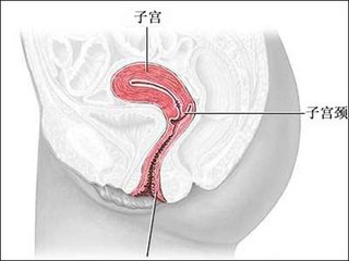 宫颈性不孕简介